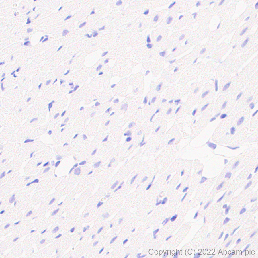 Immunohistochemistry (Formalin/PFA-fixed paraffin-embedded sections) - Anti-SCP1 antibody [EPR27085-83] (AB303520), expandable thumbnail