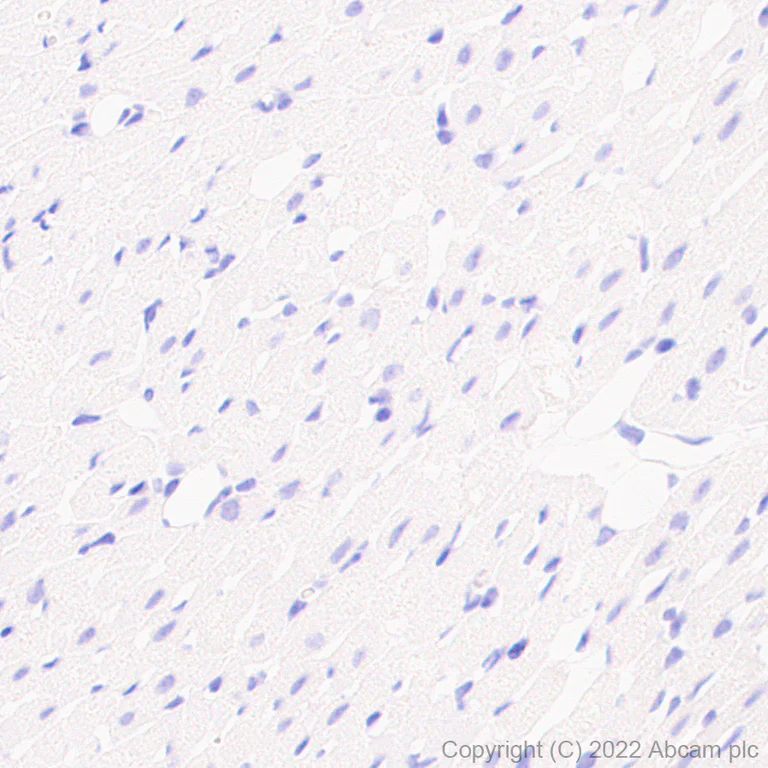 Immunohistochemistry (Formalin/PFA-fixed paraffin-embedded sections) - Anti-SCP1 antibody [EPR27085-83] (AB303520)