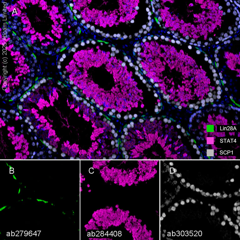 Multiplex immunohistochemistry - Anti-SCP1 antibody [EPR27085-83] (AB303520)