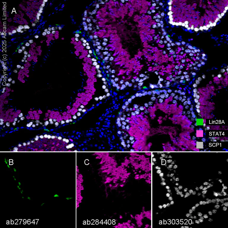 Multiplex immunohistochemistry - Anti-SCP1 antibody [EPR27085-83] (AB303520)