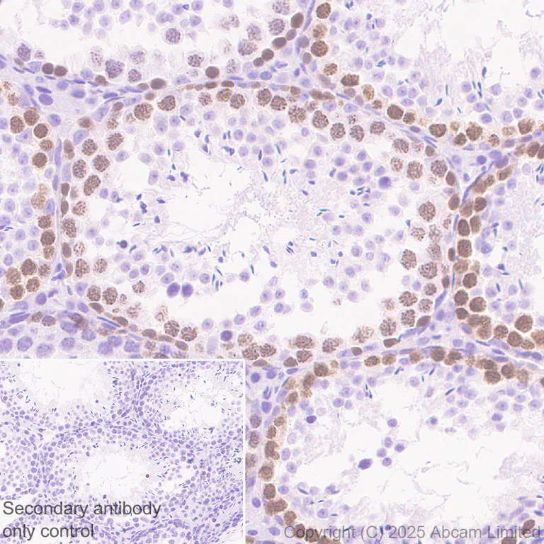 Immunohistochemistry (Formalin/PFA-fixed paraffin-embedded sections) - Anti-SCP1 antibody [EPR29778-50] (AB324729)