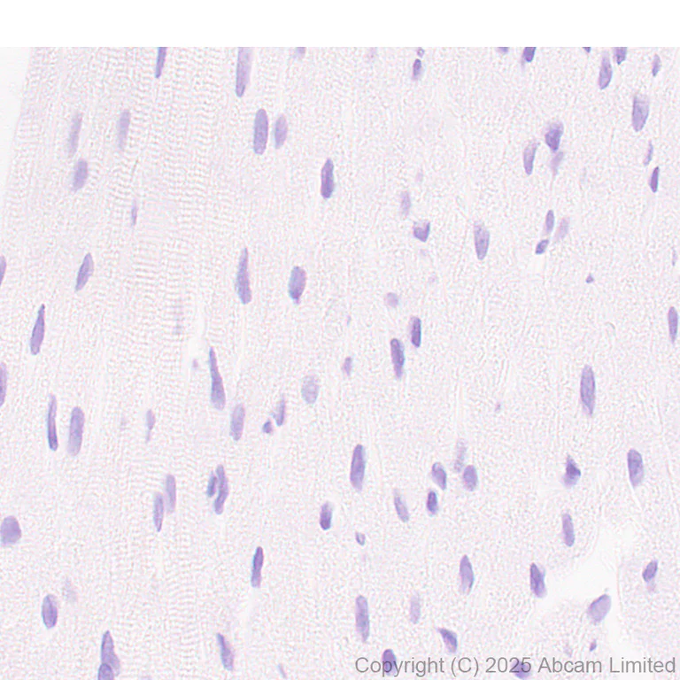 Immunohistochemistry (Formalin/PFA-fixed paraffin-embedded sections) - Anti-SCP1 antibody [EPR29778-50] - BSA and Azide free (AB324744)