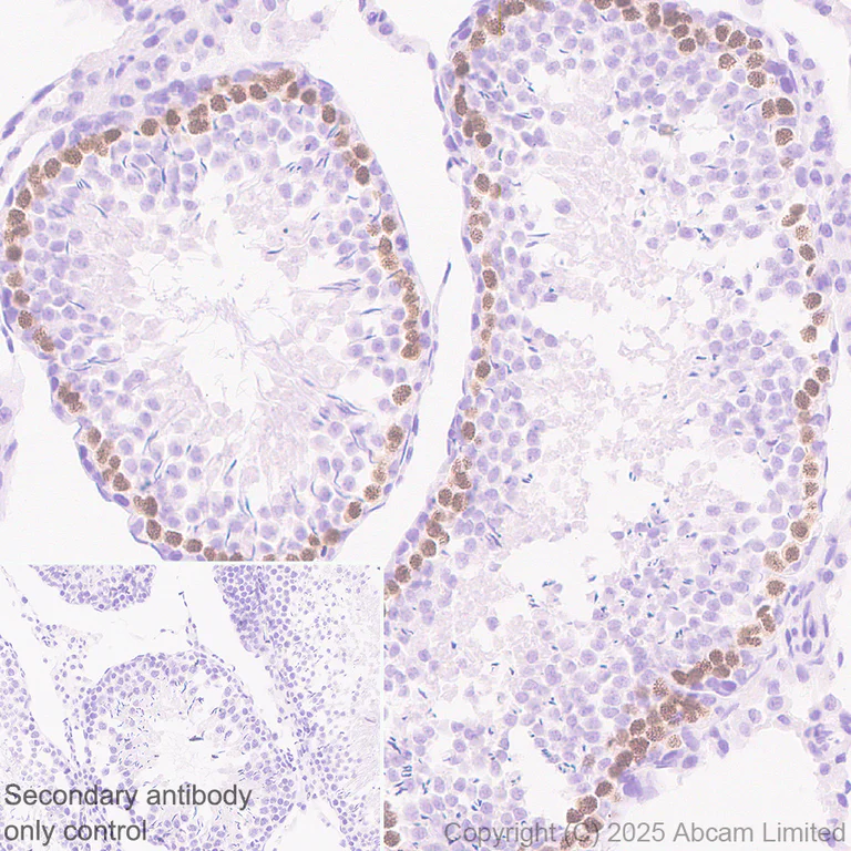 Immunohistochemistry (Formalin/PFA-fixed paraffin-embedded sections) - Anti-SCP1 antibody [EPR29778-50] - BSA and Azide free (AB324744)