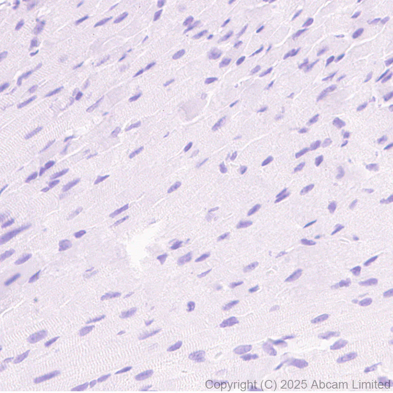 Immunohistochemistry (Formalin/PFA-fixed paraffin-embedded sections) - Anti-SCP1 antibody [EPR29778-50] - BSA and Azide free (AB324744)