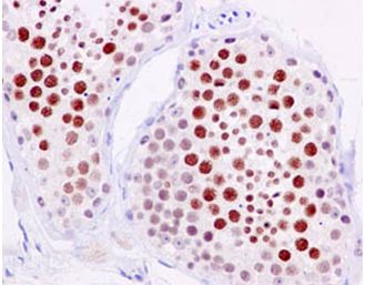 Immunohistochemistry (Formalin/PFA-fixed paraffin-embedded sections) - Anti-SCP1 antibody [EPR7919(2)] (AB184947)