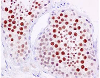 Immunohistochemistry (Formalin/PFA-fixed paraffin-embedded sections) - Anti-SCP1 antibody [EPR7919(2)] - BSA and Azide free (AB250786)