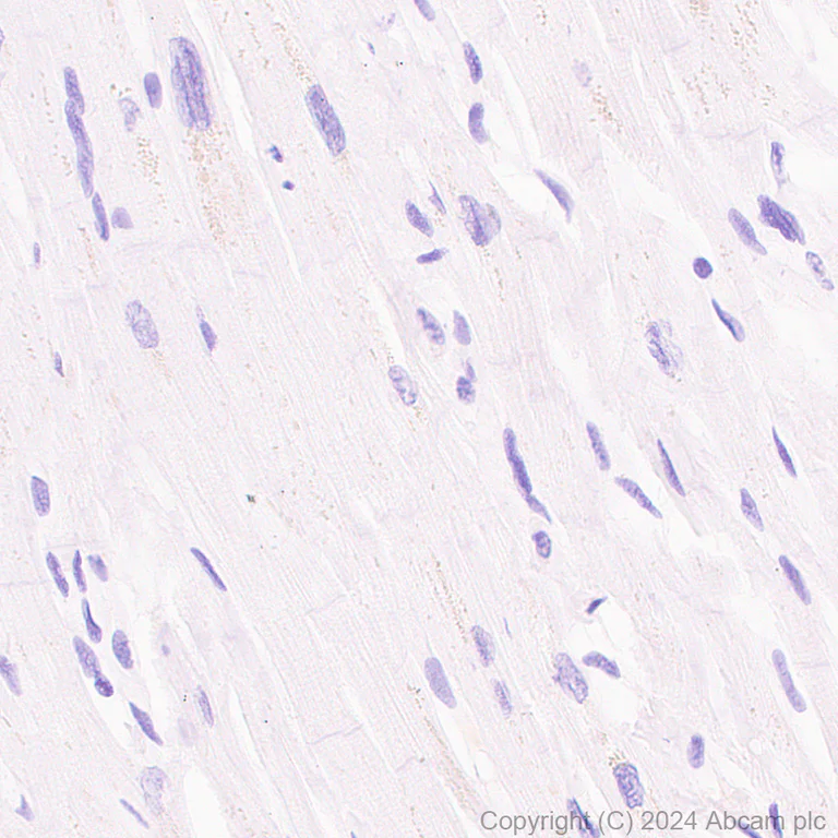 Immunohistochemistry (Formalin/PFA-fixed paraffin-embedded sections) - Anti-SCP1 antibody [RM1177] (AB322067)