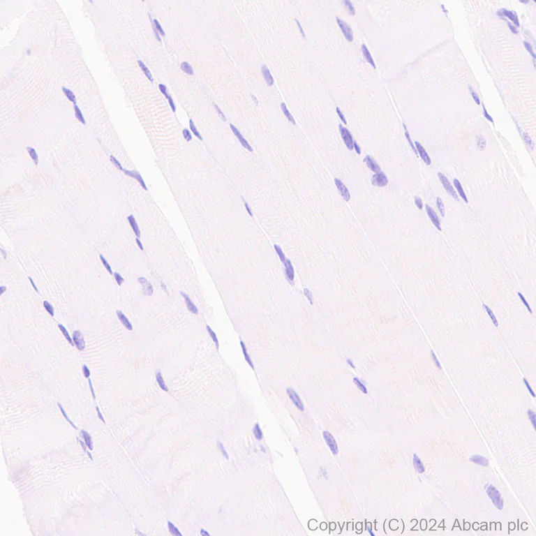 Immunohistochemistry (Formalin/PFA-fixed paraffin-embedded sections) - Anti-SCP1 antibody [RM1177] (AB322067)