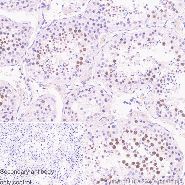 Immunohistochemistry (Formalin/PFA-fixed paraffin-embedded sections) - Anti-SCP1 antibody [RM1177] (AB322067)