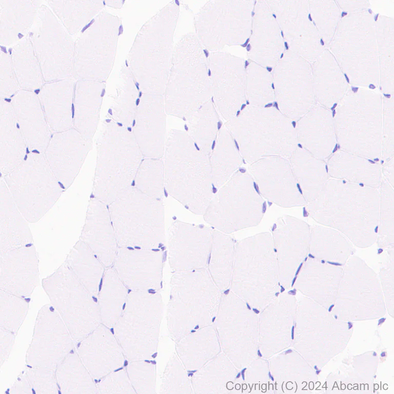 Immunohistochemistry (Formalin/PFA-fixed paraffin-embedded sections) - Anti-SCP1 antibody [RM1177] (AB322067)