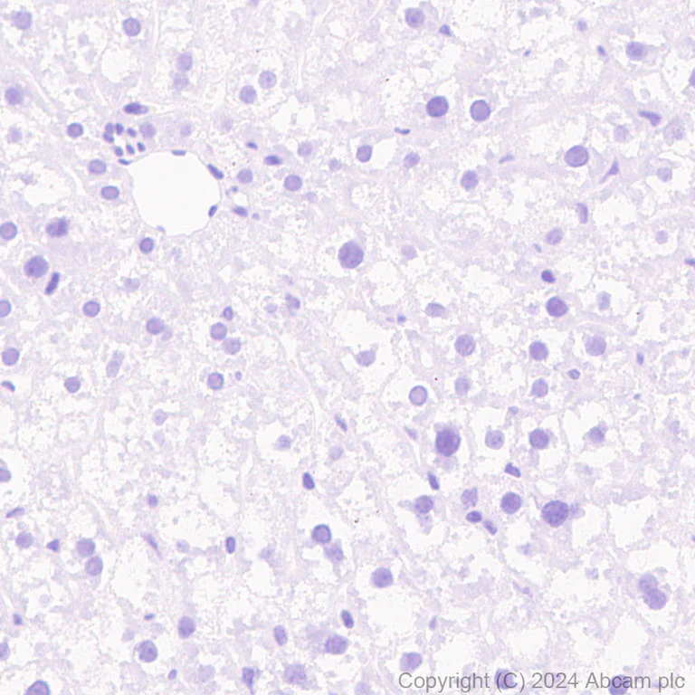 Immunohistochemistry (Formalin/PFA-fixed paraffin-embedded sections) - Anti-SCP1 antibody [RM1177] (AB322067)