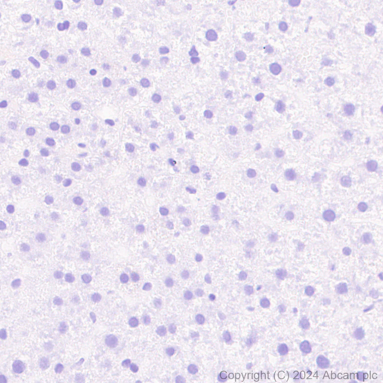Immunohistochemistry (Formalin/PFA-fixed paraffin-embedded sections) - Anti-SCP1 antibody [RM1177] (AB322067)