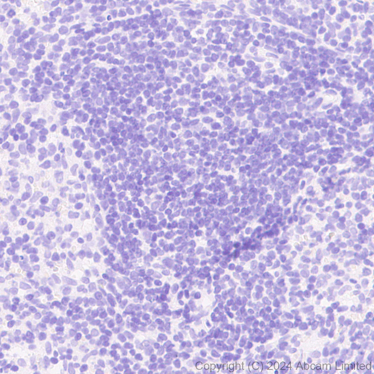 Immunohistochemistry (Formalin/PFA-fixed paraffin-embedded sections) - Anti-SCP1 antibody [RM1177] (AB322067)