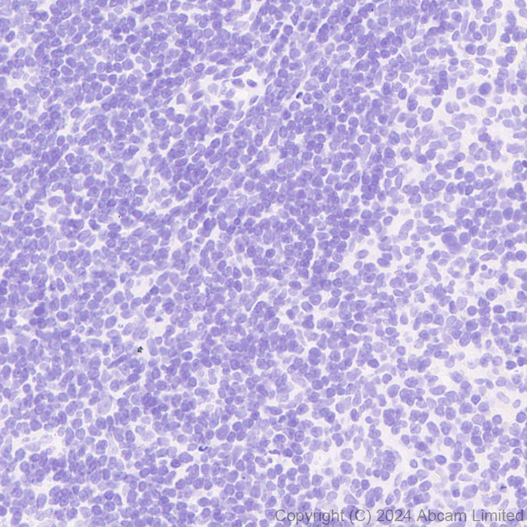Immunohistochemistry (Formalin/PFA-fixed paraffin-embedded sections) - Anti-SCP1 antibody [RM1177] (AB322067)