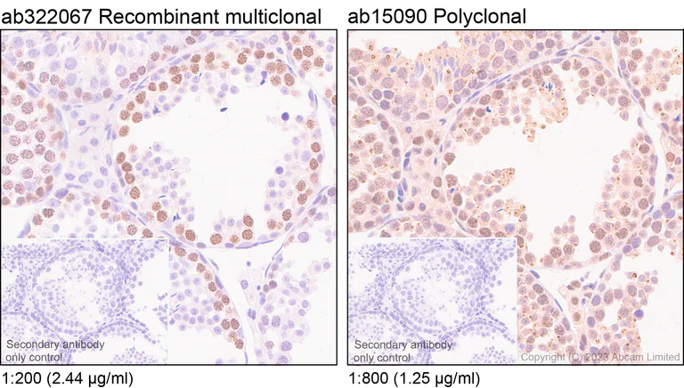Immunohistochemistry (Formalin/PFA-fixed paraffin-embedded sections) - Anti-SCP1 antibody [RM1177] (AB322067)