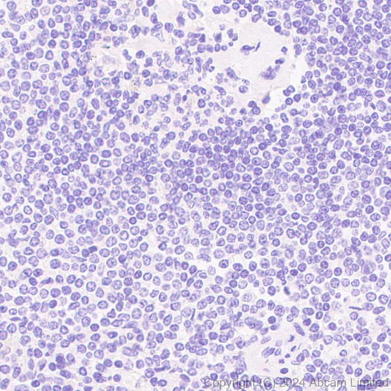 Immunohistochemistry (Formalin/PFA-fixed paraffin-embedded sections) - Anti-SCP1 antibody [RM1177] (AB322067)