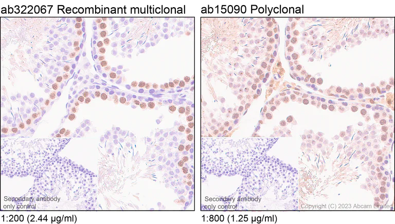 Immunohistochemistry (Formalin/PFA-fixed paraffin-embedded sections) - Anti-SCP1 antibody [RM1177] (AB322067)