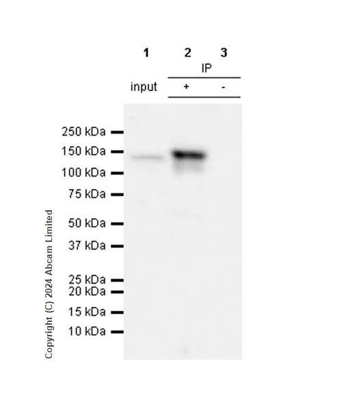 Immunoprecipitation - Anti-SCP1 antibody [RM1177] (AB322067)