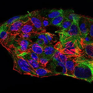Immunocytochemistry/ Immunofluorescence - Anti-SCP3 antibody [6F9C5] (AB181746)