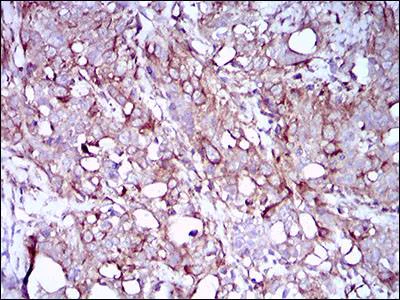 Immunohistochemistry (Formalin/PFA-fixed paraffin-embedded sections) - Anti-SCP3 antibody [6F9C5] (AB181746)