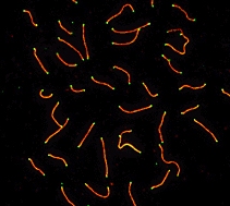 Immunocytochemistry/ Immunofluorescence - Anti-SCP3 antibody (AB15093)