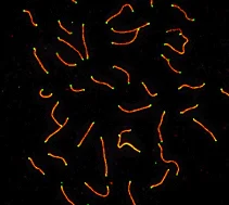 Immunocytochemistry/ Immunofluorescence - Anti-SCP3 antibody (AB15093)