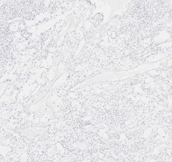 Immunohistochemistry (Formalin/PFA-fixed paraffin-embedded sections) - Anti-SCP3 antibody (AB235254), expandable thumbnail