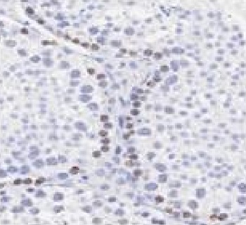 Immunohistochemistry (Formalin/PFA-fixed paraffin-embedded sections) - Anti-SCP3 antibody (AB235254), expandable thumbnail