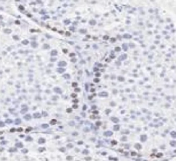 Immunohistochemistry (Formalin/PFA-fixed paraffin-embedded sections) - Anti-SCP3 antibody (AB235254)