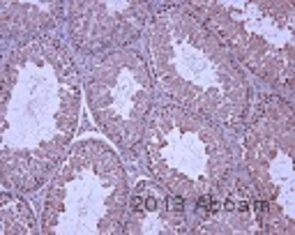 Immunohistochemistry (Formalin/PFA-fixed paraffin-embedded sections) - Anti-SCP3 antibody [Cor 10G11/7] (AB97672)