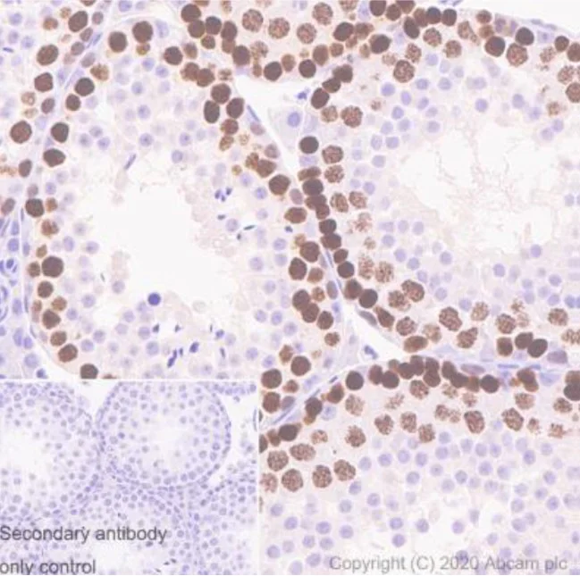 Immunohistochemistry (Formalin/PFA-fixed paraffin-embedded sections) - Anti-SCP3 antibody [Cor 10G11/7] (AB97672)