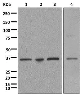 Western blot - Anti-SCP3 antibody [EPR12695(B)] - BSA and Azide free (AB250482)