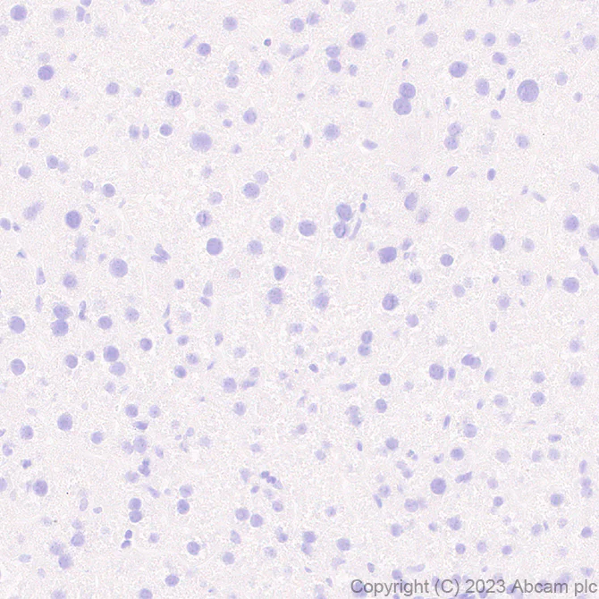Immunohistochemistry (Formalin/PFA-fixed paraffin-embedded sections) - Anti-SCP3 antibody [EPR27086-10] (AB314751)