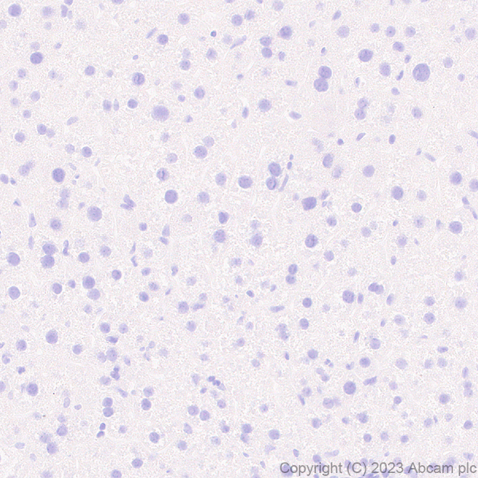 Immunohistochemistry (Formalin/PFA-fixed paraffin-embedded sections) - Anti-SCP3 antibody [EPR27086-10] - BSA and Azide free (AB314752), expandable thumbnail
