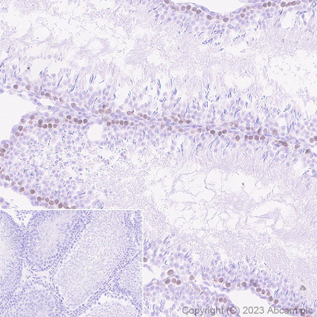 Immunohistochemistry (Formalin/PFA-fixed paraffin-embedded sections) - Anti-SCP3 antibody [EPR27086-101] (AB314313)