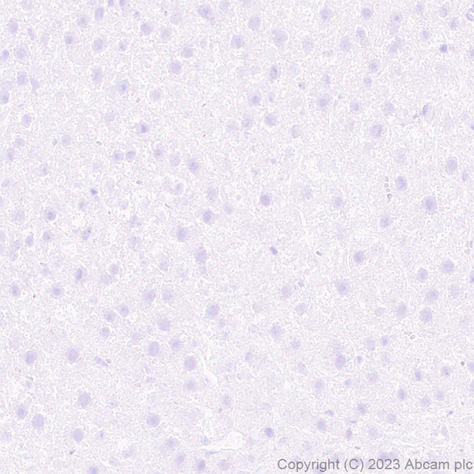 Immunohistochemistry (Formalin/PFA-fixed paraffin-embedded sections) - Anti-SCP3 antibody [EPR27086-101] (AB314313)