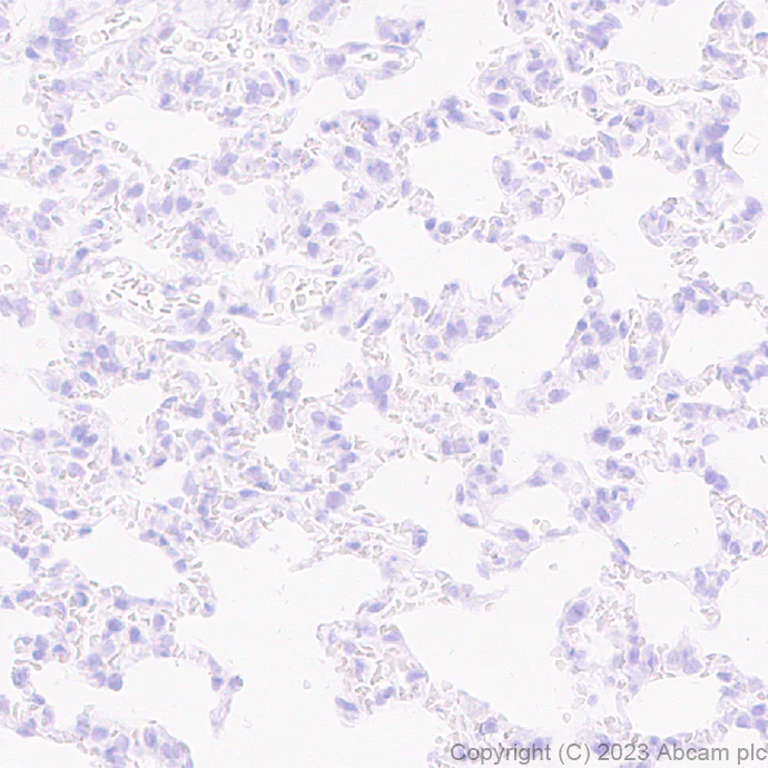Immunohistochemistry (Formalin/PFA-fixed paraffin-embedded sections) - Anti-SCP3 antibody [EPR27086-101] (AB314313)
