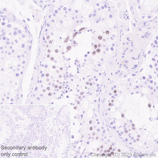 Immunohistochemistry (Formalin/PFA-fixed paraffin-embedded sections) - Anti-SCP3 antibody [EPR27086-101] - BSA and Azide free (ab314314), expandable thumbnail