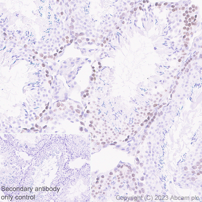 Immunohistochemistry (Formalin/PFA-fixed paraffin-embedded sections) - Anti-SCP3 antibody [EPR27086-101] - BSA and Azide free (ab314314), expandable thumbnail