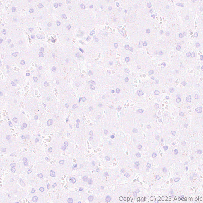Immunohistochemistry (Formalin/PFA-fixed paraffin-embedded sections) - Anti-SCP3 antibody [EPR27086-101] - BSA and Azide free (ab314314), expandable thumbnail