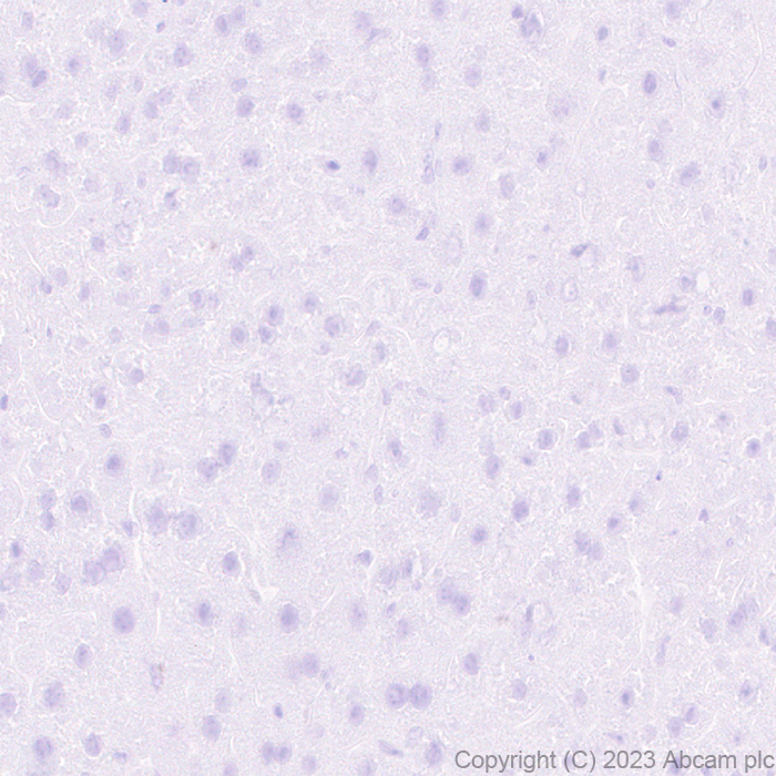 Immunohistochemistry (Formalin/PFA-fixed paraffin-embedded sections) - Anti-SCP3 antibody [EPR27086-101] - BSA and Azide free (AB314314), expandable thumbnail