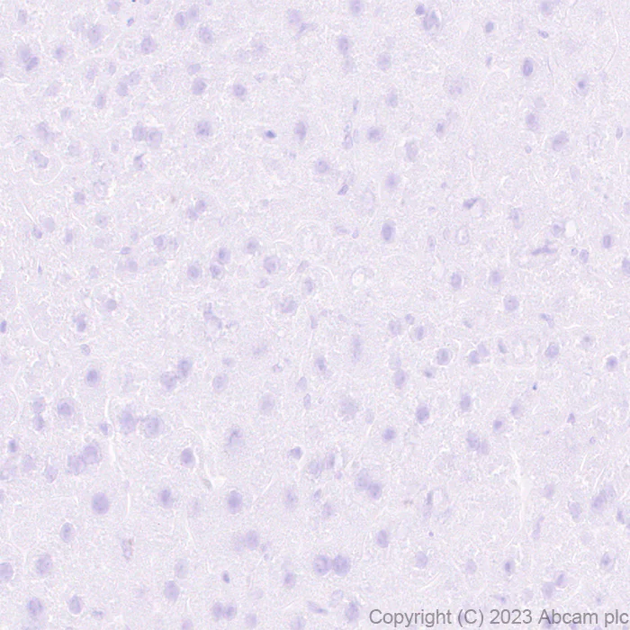 Immunohistochemistry (Formalin/PFA-fixed paraffin-embedded sections) - Anti-SCP3 antibody [EPR27086-101] - BSA and Azide free (AB314314)