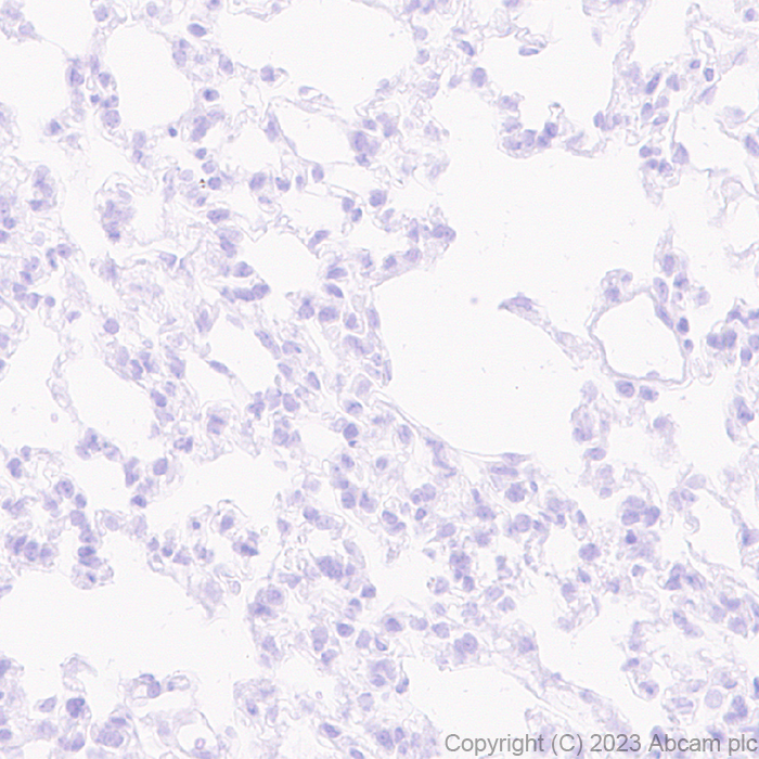 Immunohistochemistry (Formalin/PFA-fixed paraffin-embedded sections) - Anti-SCP3 antibody [EPR27086-101] - BSA and Azide free (AB314314), expandable thumbnail