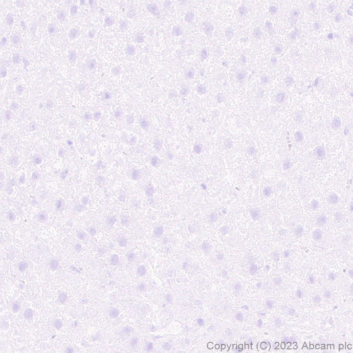 Immunohistochemistry (Formalin/PFA-fixed paraffin-embedded sections) - Anti-SCP3 antibody [EPR27086-101] - BSA and Azide free (AB314314), expandable thumbnail