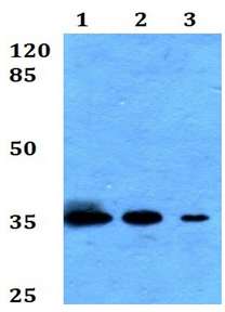 Western blot - Anti-Scramblase 1 antibody (AB191514)