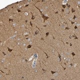 Immunohistochemistry (Formalin/PFA-fixed paraffin-embedded sections) - Anti-SCRG1 antibody (AB121384)
