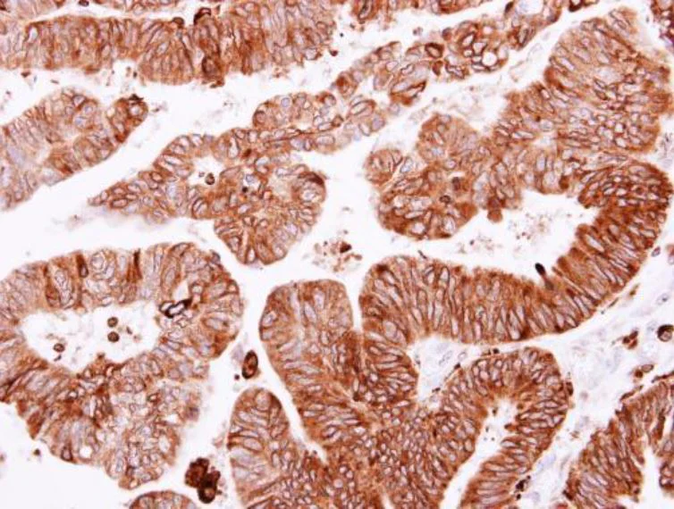 Immunohistochemistry (Formalin/PFA-fixed paraffin-embedded sections) - Anti-SCRIBBLE antibody (AB154067)