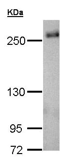 Western blot - Anti-SCRIBBLE antibody (AB154067)