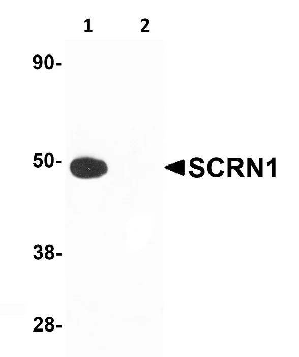 Western blot - Anti-SCRN1 antibody (AB105355)