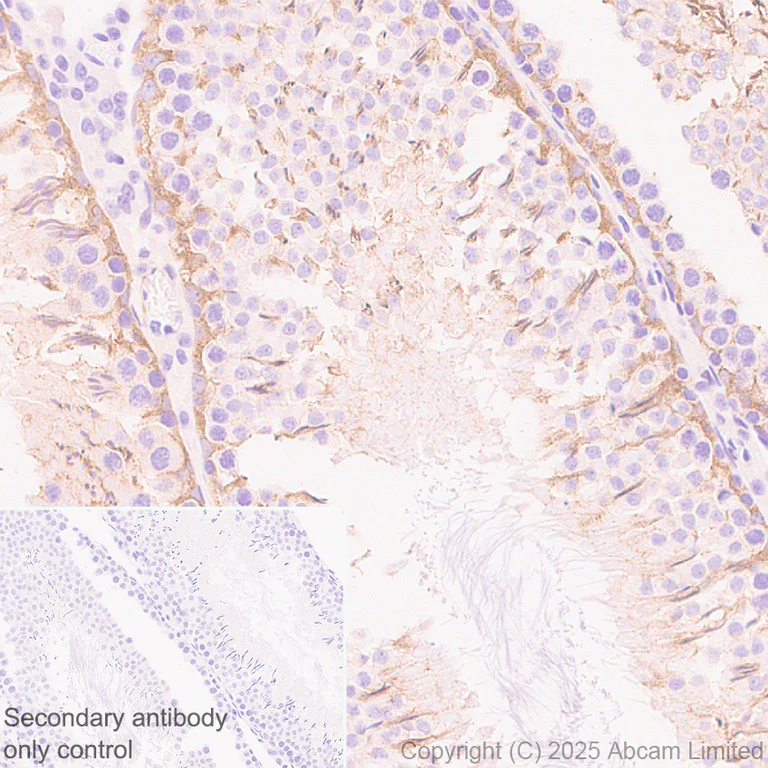 Immunohistochemistry (Formalin/PFA-fixed paraffin-embedded sections) - Anti-SCRN1 antibody [EPR29587-538] (AB323711)